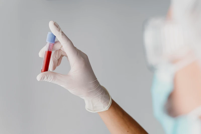 mano con guanto bianco sostenendo provetta esame prostata psa
