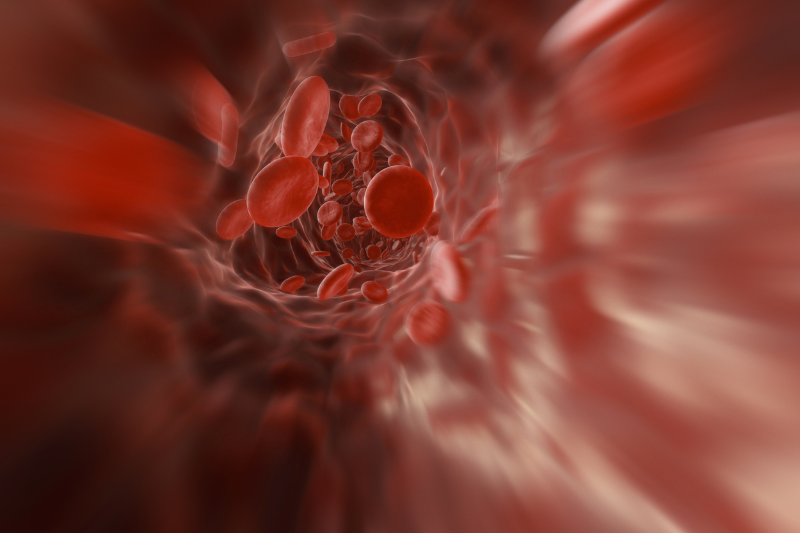 Anemia: cos’è, quali sono le cause e come affrontarla con l’alimentazione